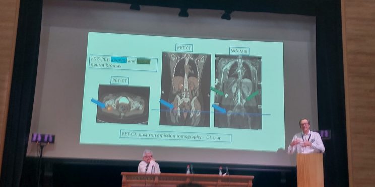 Fotografía Congreso Neurofibromatosis 2024